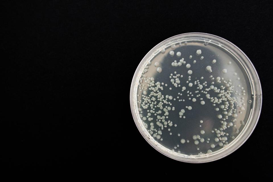 petri dish
