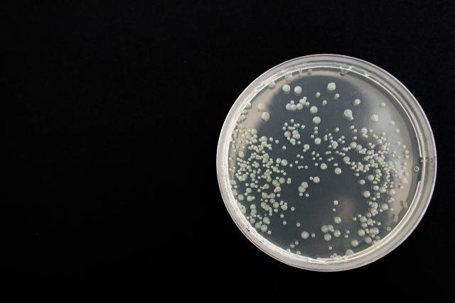petri dish